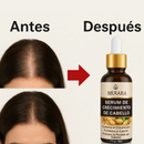 COMPRE 1 Y LLÉVETE 2 - Golden Hair Murara - Crecimiento De Cabello Rapido