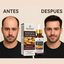 COMPRE 1 Y LLÉVETE 2 - Golden Hair Murara - Crecimiento De Cabello Rapido
