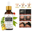 COMPRE 1 Y LLÉVETE 2 - Golden Hair Murara - Crecimiento De Cabello Rapido