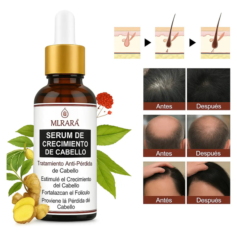 COMPRE 1 Y LLÉVETE 2 - Golden Hair Murara - Crecimiento De Cabello Rapido